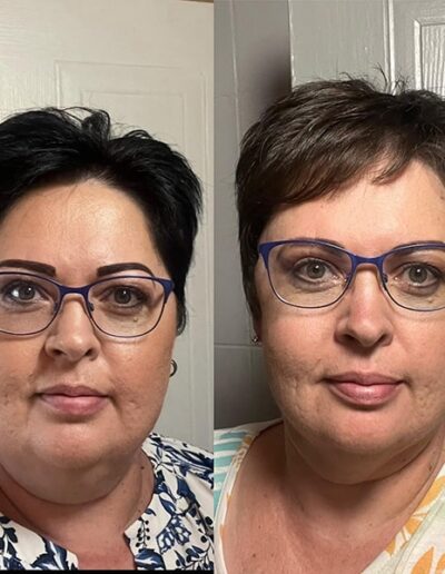 The Exodus Experience Before After 09